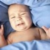 Вродените дефекти на предната коремна стена, целозомии, Омфалоцелето може да бъде неусложнено и усложнено, Лапаросхиза (gastroshisis)