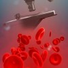 Гликираният хемоглобин A1c е показател за контрола на захарния диабет,hemoglobin A1c,< 6,5% показва добра компенсация на захарния диабет,удължен живот на еритроцитите - железен дефицит