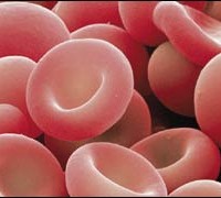 Желязо свързващи продукти (ЖСК) се използва за диагностика на отклонения в железния метаболизъм