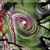 скаленус синдром, Thoracic outlet syndrome, исхемия на горния крайник, синдром на Рейно, идиопатична медиална ,артериопатия