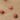Заразни молуски (Контагиозен молускум (Molluscum contagiosum))