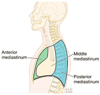 13792_mediatinal_tumors
