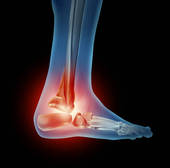 ankle