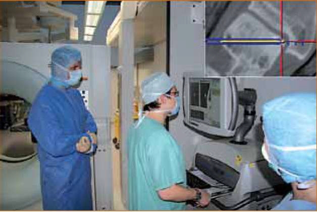 Googleimages.com Лечение на деформираща артроза,Терапия на Osteochondrosis dissecans tali, дебридман на хрущялната част, размекване на хрущяла, Дисекиран фрагмент in situ, лечение на артроза, заболяване на костите