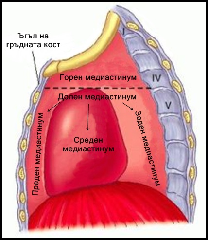 Тумори на задния медиастинум, рак на белия дроб, рак на бял дроб, рак бял дроб, видове рак на белия дроб, рак на белите дробове лечение, тумор на бял дроб